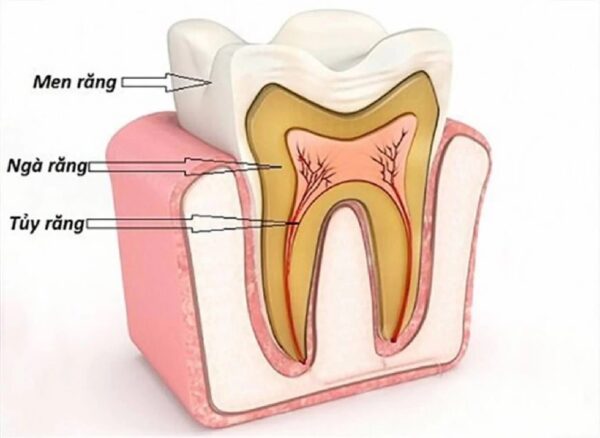 Điều trị nội nha được chỉ định cho trường hợp bị tổn thương tủy răng