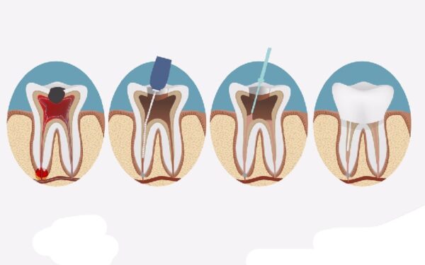 Nha khoa City Smiles cung cấp quy trình điều trị đúng chuẩn Bộ Y Tế