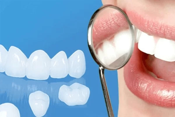 Nha Khoa City Smiles - Trồng Răng Implant, Bọc Răng Sứ, Riềng Răng Uy Tín Tại HCM 42