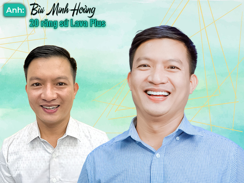 Nha Khoa City Smiles - Trồng Răng Implant, Bọc Răng Sứ, Riềng Răng Uy Tín Tại HCM 33