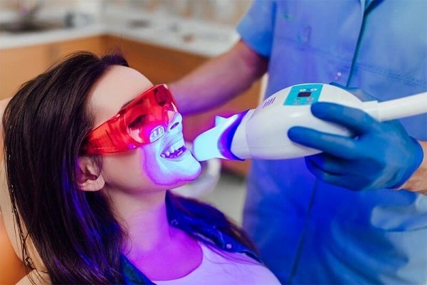 Cách làm trắng răng bị vàng bằng tẩy trắng laser