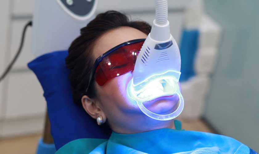 Điểm qua những lợi ích của tẩy trắng răng Laser Whitening