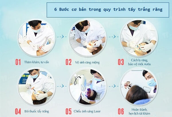 Quy trình tẩy trắng răng tại Nha Khoa City Smiles