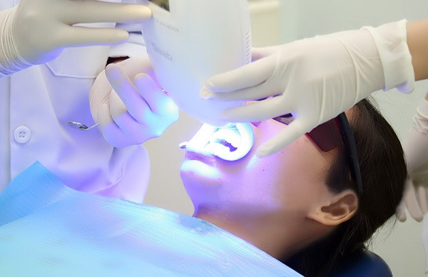 Công nghệ tẩy trắng răng Laser Whitening là gì?