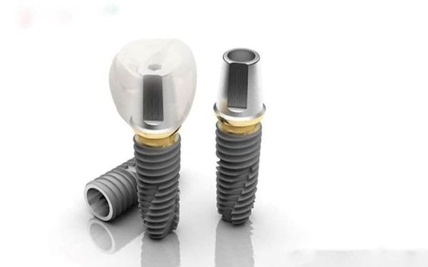 Răng implant loại nào tốt 3