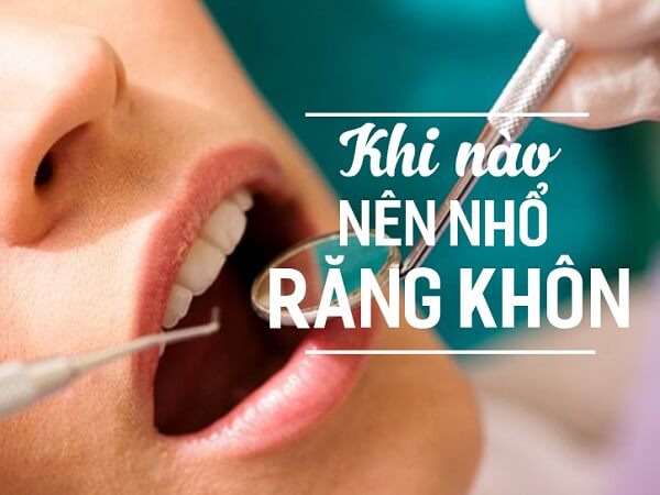 Khi nào nên nhổ răng khôn?