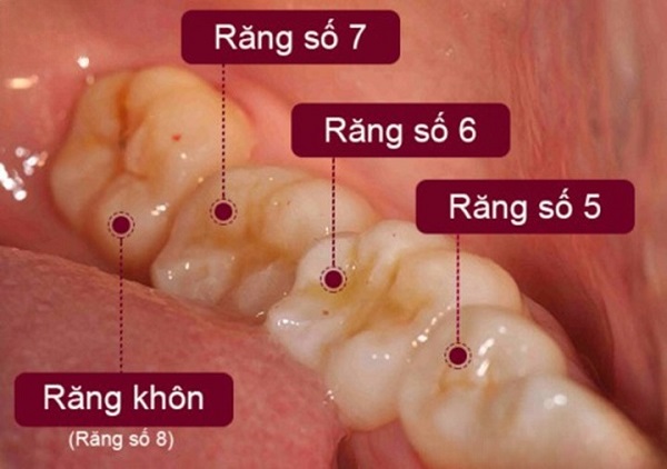 Các vị trí răng