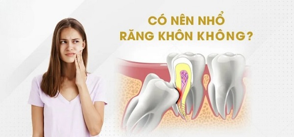 Khi nào nên nhổ răng khôn? Có nên nhổ răng khôn không?