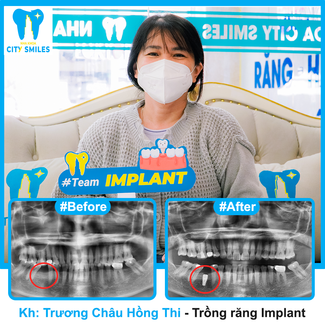 Phòng Khám Nha Khoa Tân Phú - Uy Tín Xuất Phát Từ Tâm 19