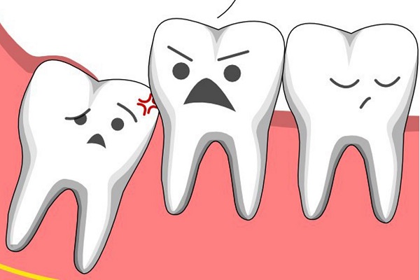 Răng số 8 là răng gì?