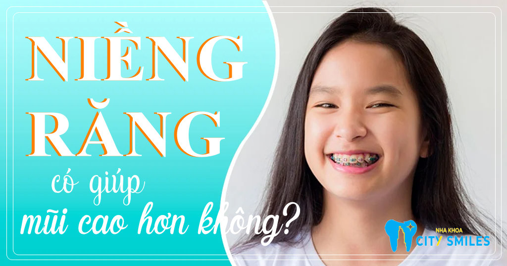 Niềng răng có giúp mũi cao hơn không? - Nha Khoa City Smiles