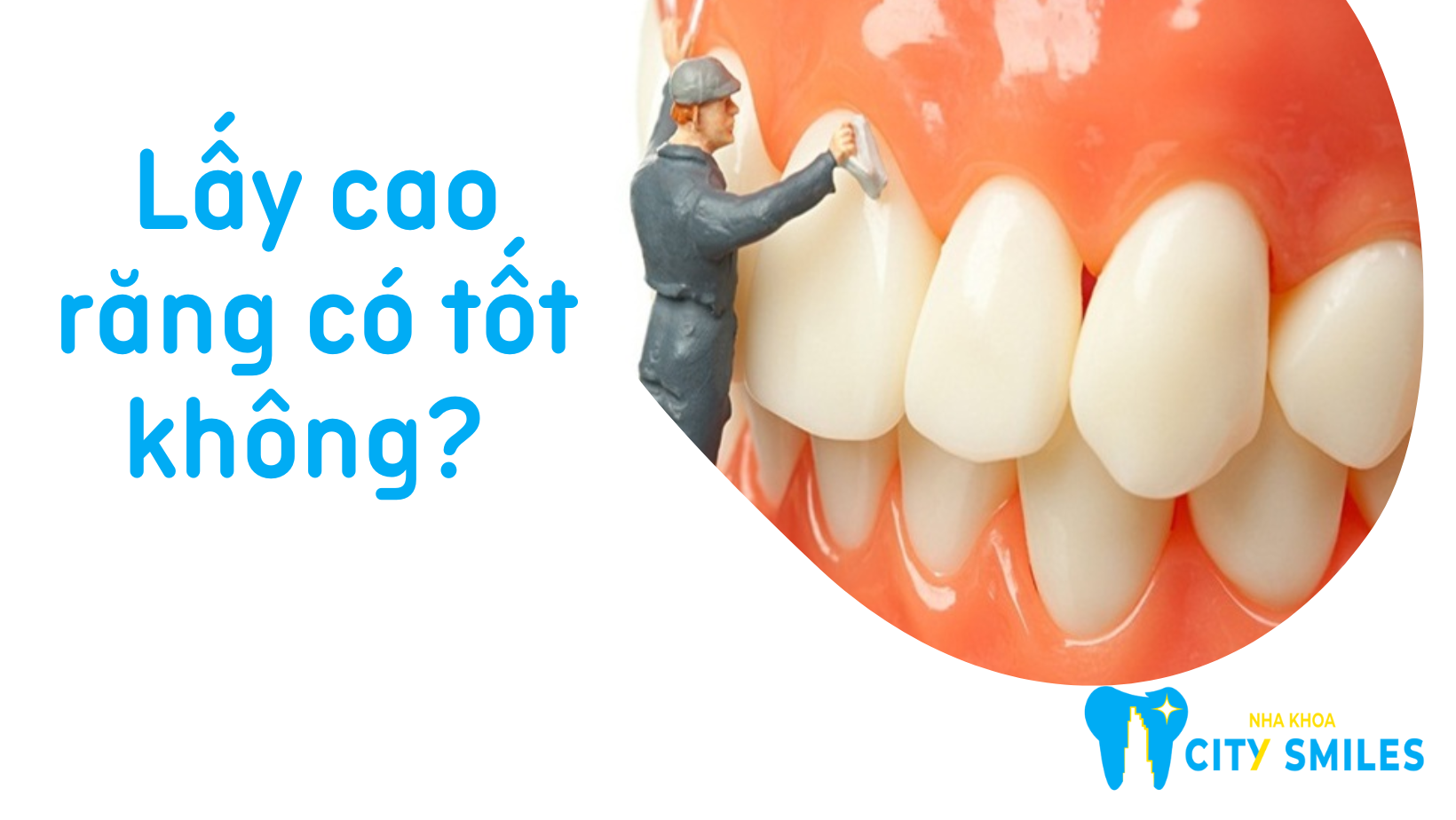 Lấy cao răng có tốt không?