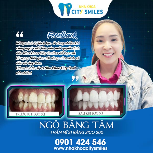 Niềng răng thành công tại Nha khoa City Smiles