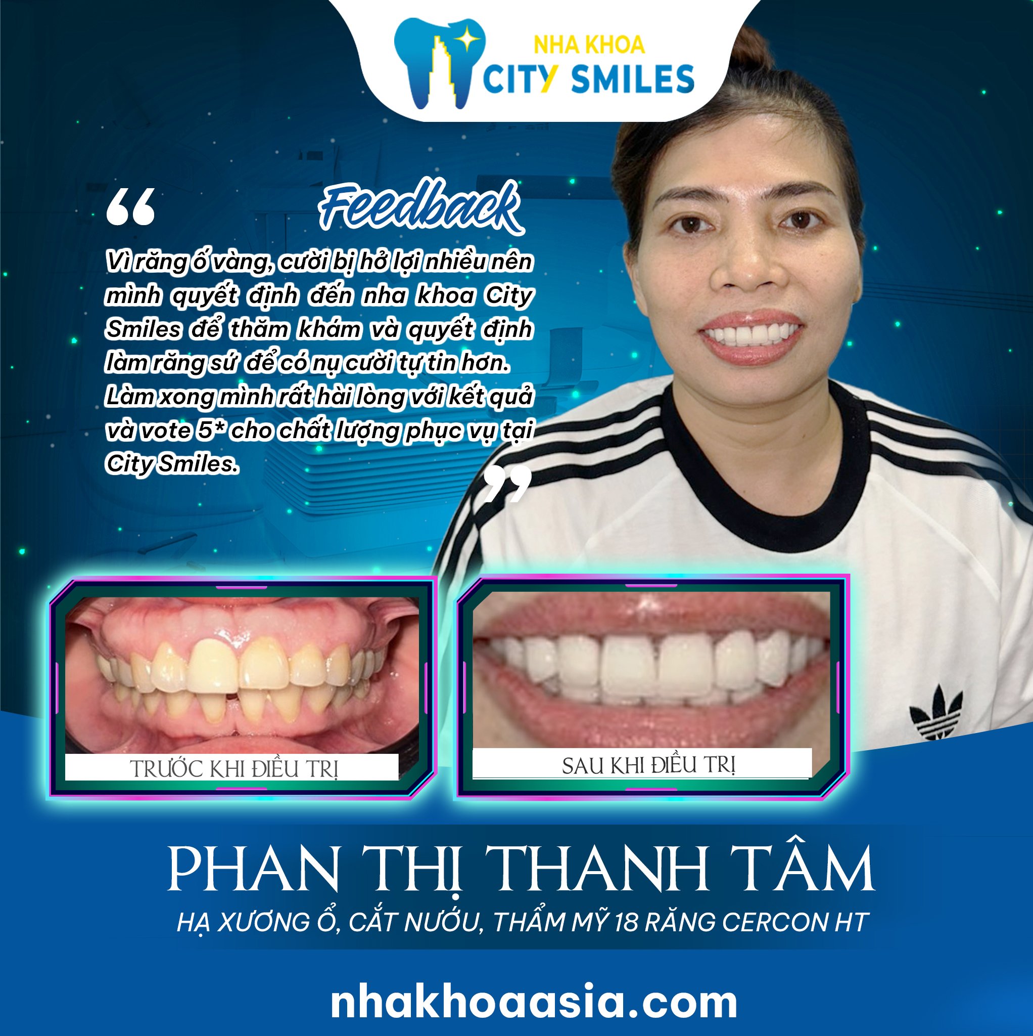 Niềng răng thành công tại Nha khoa City Smiles