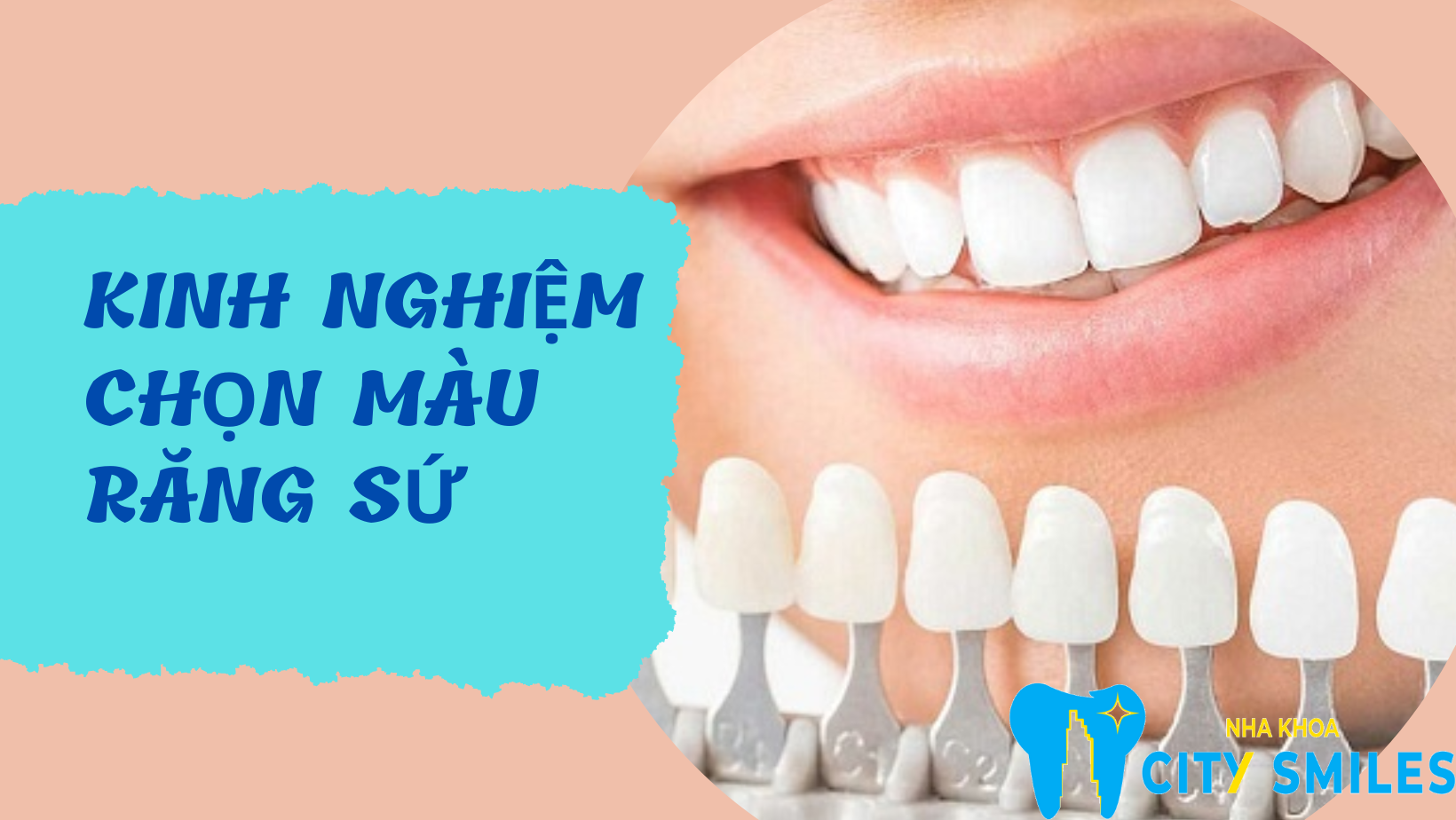 Kinh nghiệm chọn màu răng sứ chuẩn, đẹp nhất hiện nay