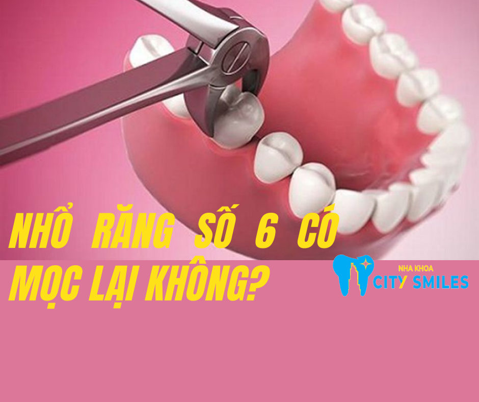 Nhổ răng số 6 có mọc lại không? 4