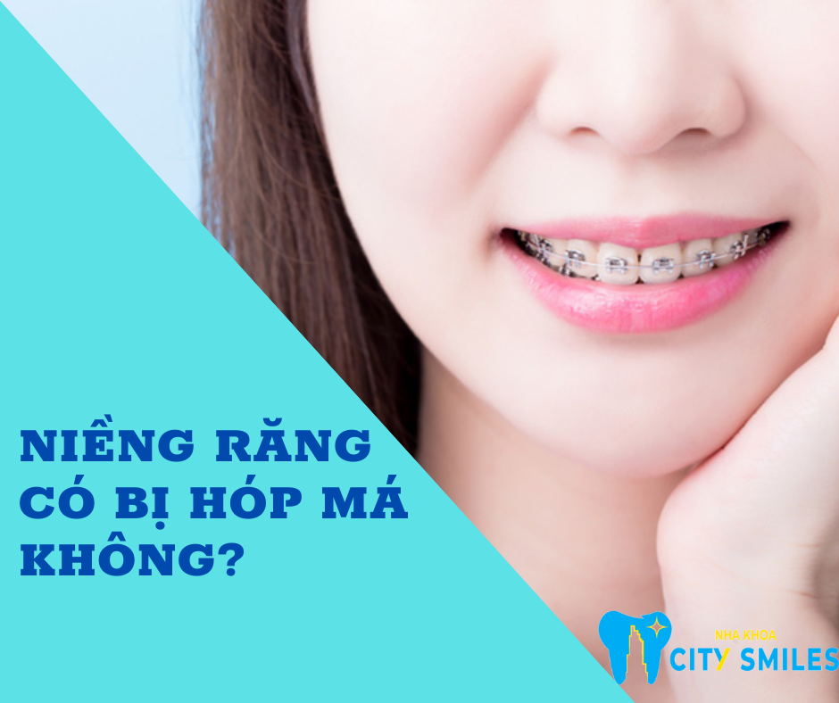 Niềng răng có bị hóp má không? Nguyên nhân và cách khắc phục