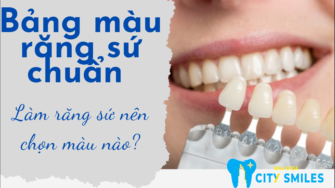 Bảng màu răng sứ chuẩn