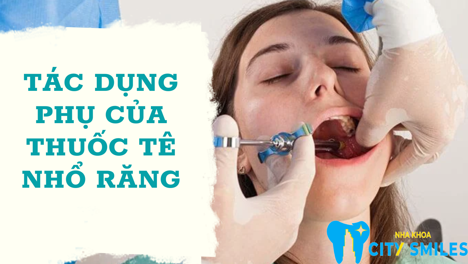 Tác dụng phụ của thuốc tê nhổ răng 1