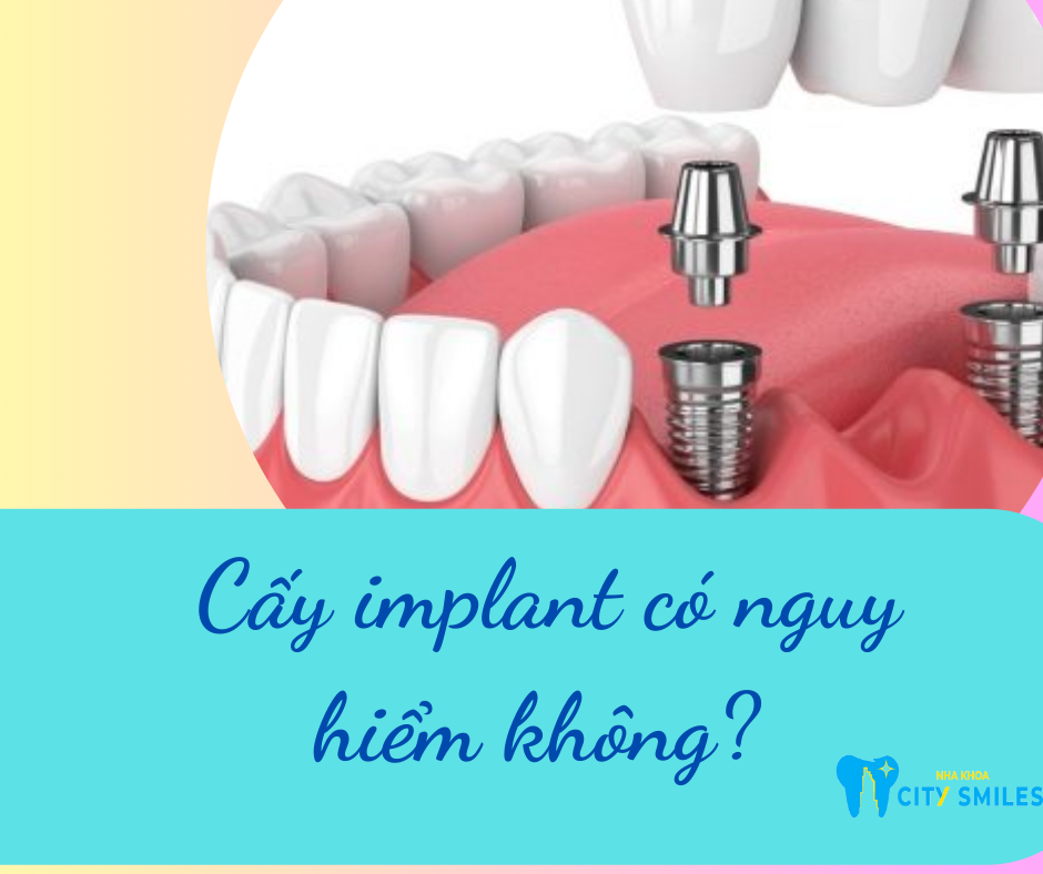 Cấy implant có nguy hiểm không