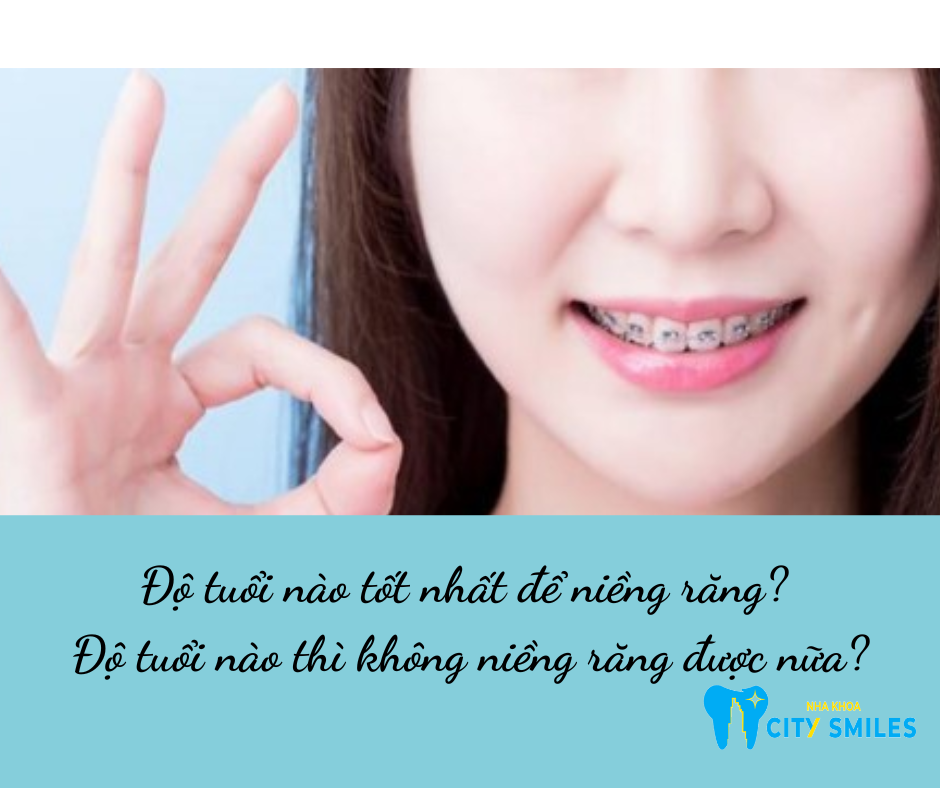 Độ tuổi nào tốt nhất để niềng răng? Độ tuổi nào thì không niềng răng được nữa?