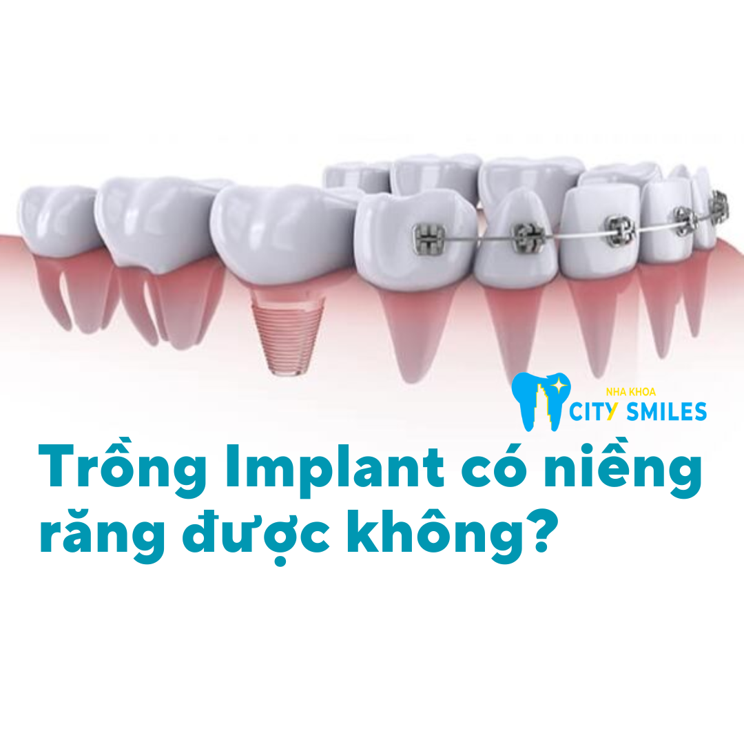 Trồng răng có niềng được không?