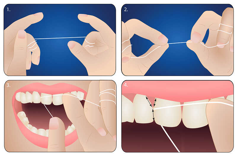 Cách dùng chỉ nha khoa dạng cuộn