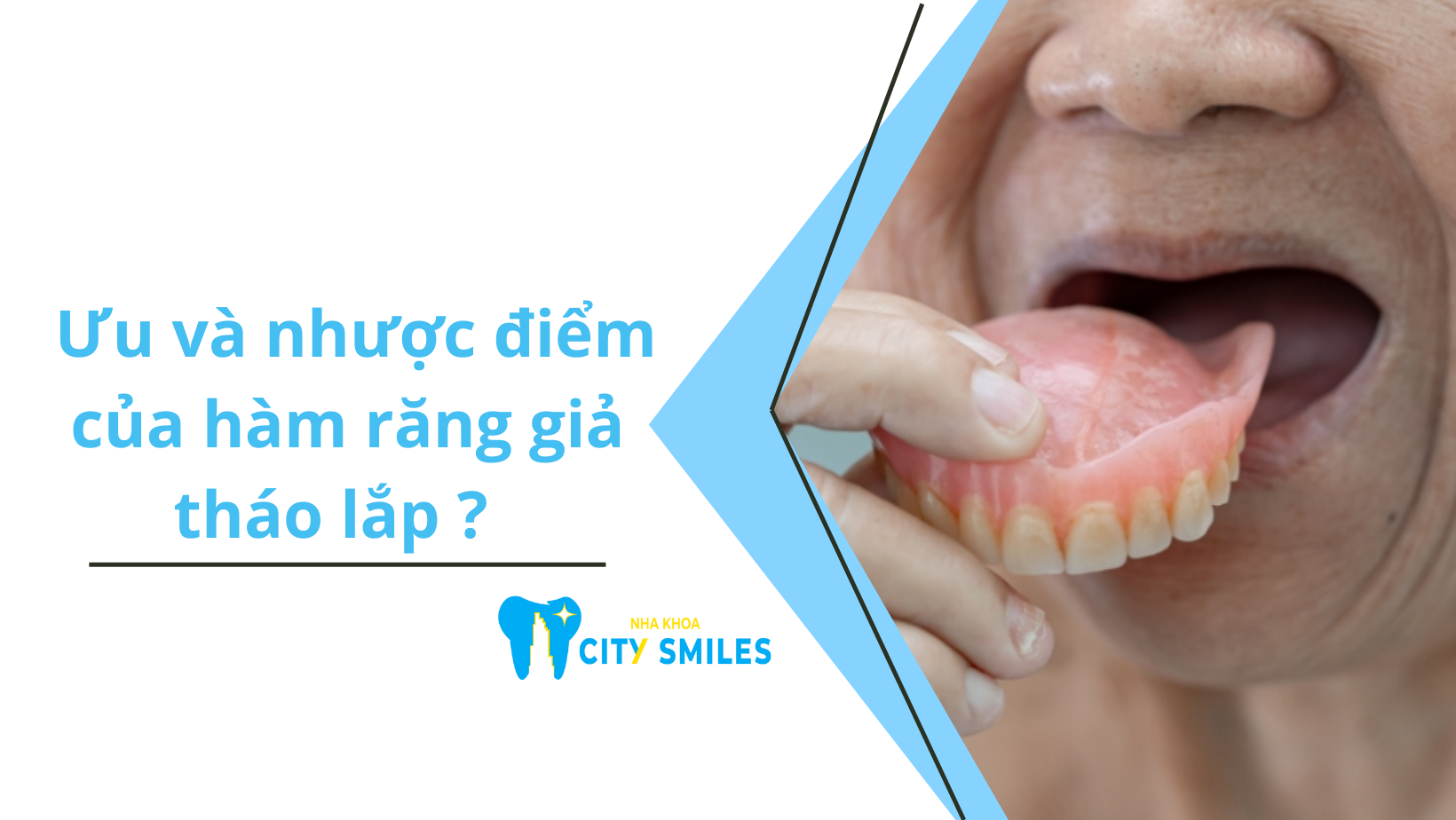 Ưu và nhược điểm của hàm răng giả tháo lắp như thế nào?