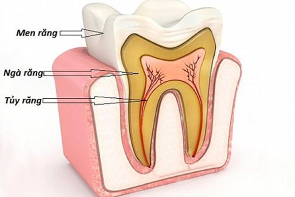 chữa tủy răng