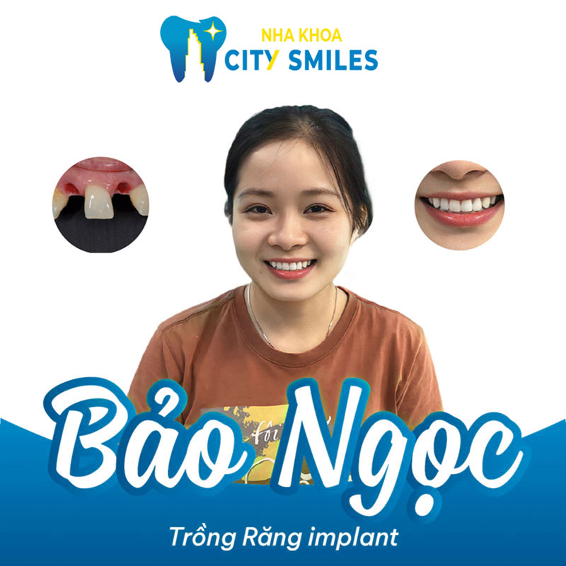Trang chủ mới 65
