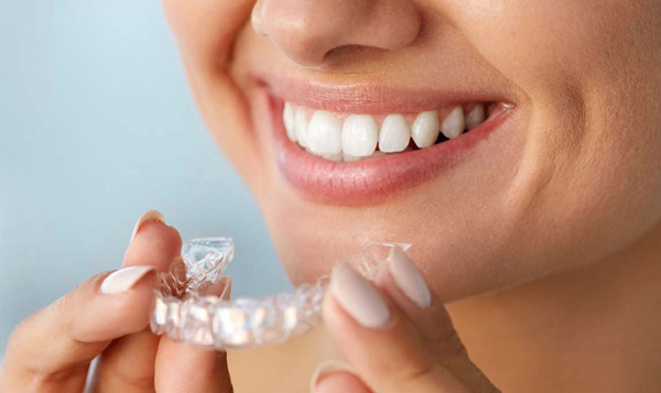 Niềng răng invisalign là phương pháp mới để chỉnh nha hiện đại, tiên tiến, thẩm mỹ cao