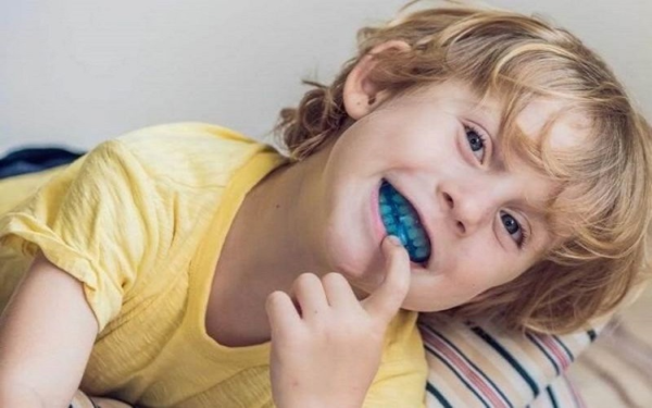Hàm Trainer là một công cụ hỗ trợ niềng răng độc đáo giúp trẻ em điều chỉnh vị trí răng miệng một cách dịu nhẹ và hiệu quả