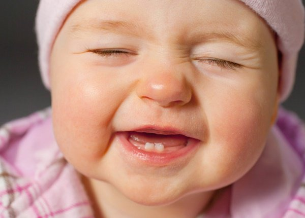 Răng sữa là những chiếc răng đầu tiên xuất hiện trong hàm răng của trẻ em