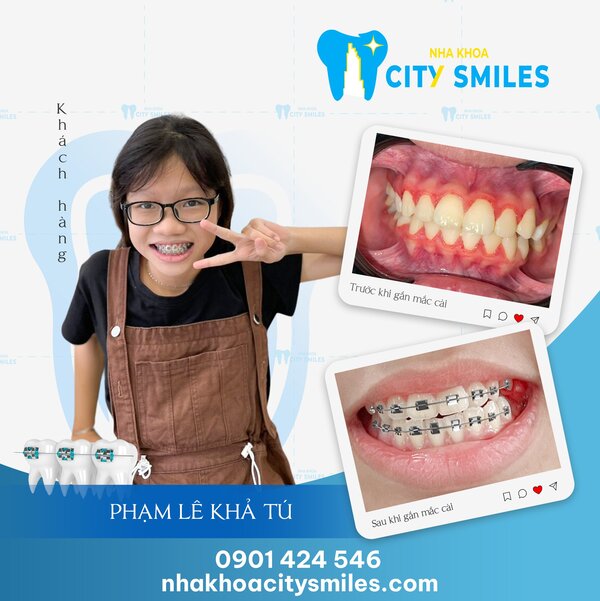 Đánh giá từ khách hàng sau khi chăm sóc và điều trị răng tại Nha Khoa City Smiles