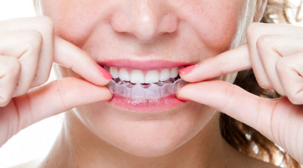 Việc sử dụng khay niềng Invisalign không chỉ giúp bạn có được nụ cười đều đặn mà còn mang lại sự thuận tiện không ngờ