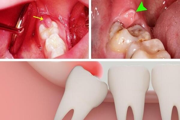 Các dấu hiệu nhận biết