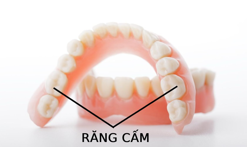 Răng cấm là răng thế nào? Giá nhổ răng cấm bao nhiêu tiền?