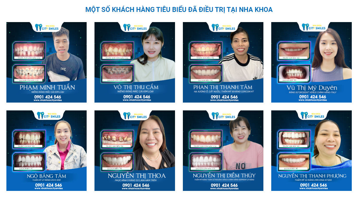 Một số khách hàng đã tin tưởng lựa chọn Nha Khoa CitySmile