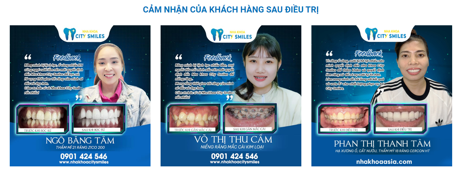 Cảm nhận khách hàng khi đã điều trị tại Nha khoa City Smiles