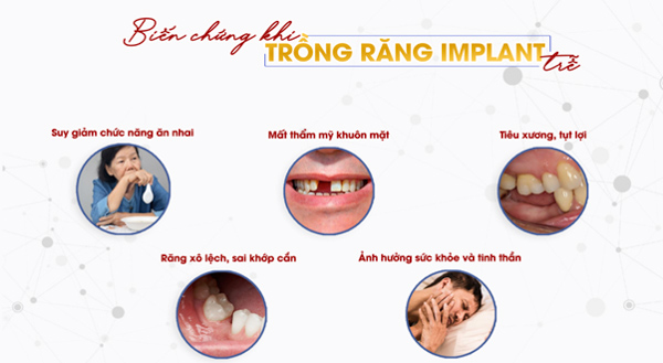 Biến chứng khi trồng răng implant trễ