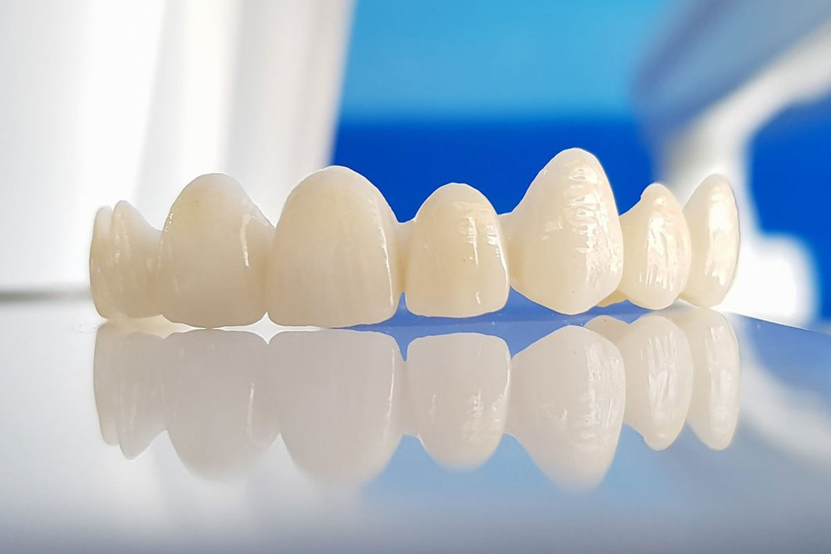 Răng sứ Zirconia với vẻ ngoại hình trong suốt và sức mạnh độc đáo