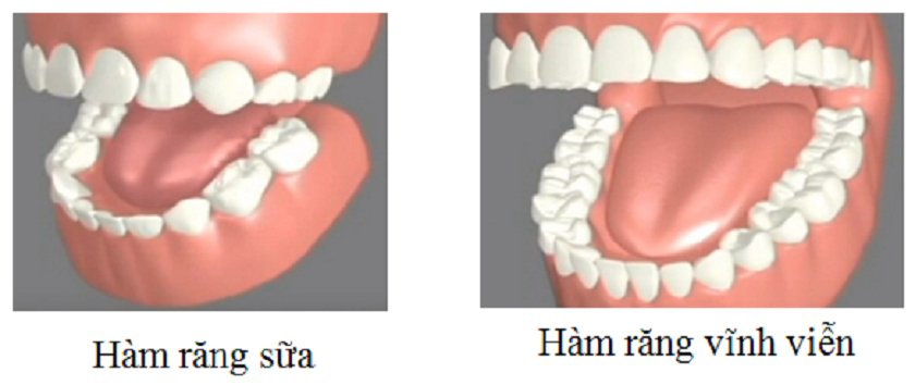 Răng sữa và răng vĩnh viễn trên cung hàm của mỗi người