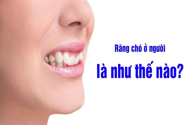 Răng chó là gì? Chi tiết số học nhân tướng răng chó chi tiết