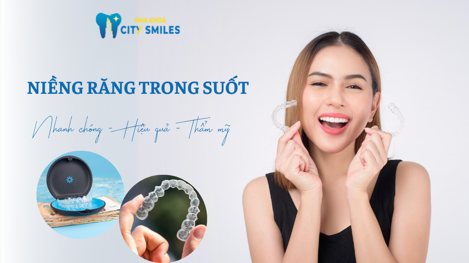 niềng răng trong suốt