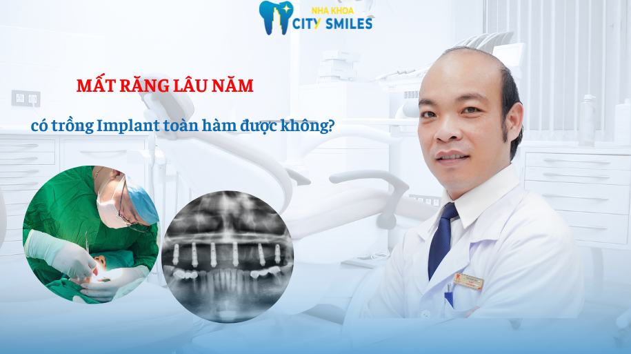 trồng răng Implant toàn hàm