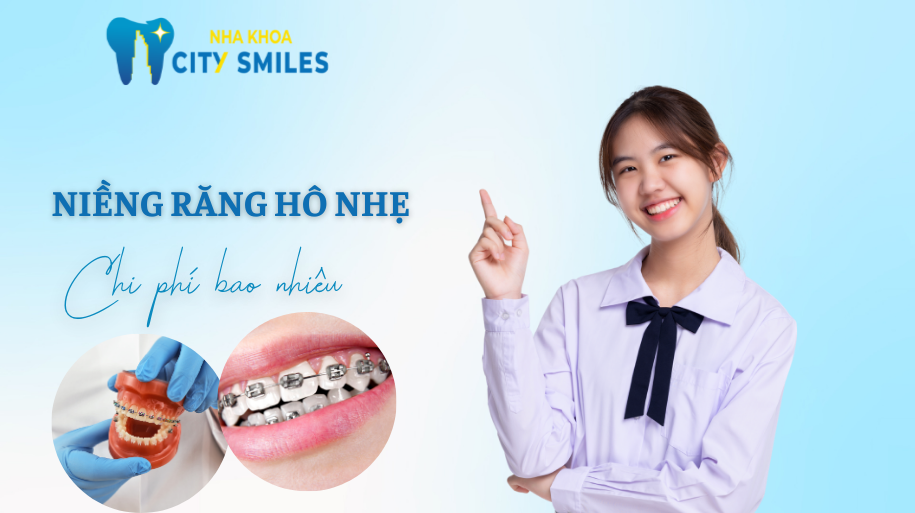 niềng răng hô nhẹ