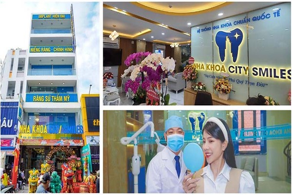 Nha khoa CitySmiles - Địa chỉ nha khoa chữa sâu răng cửa uy tín