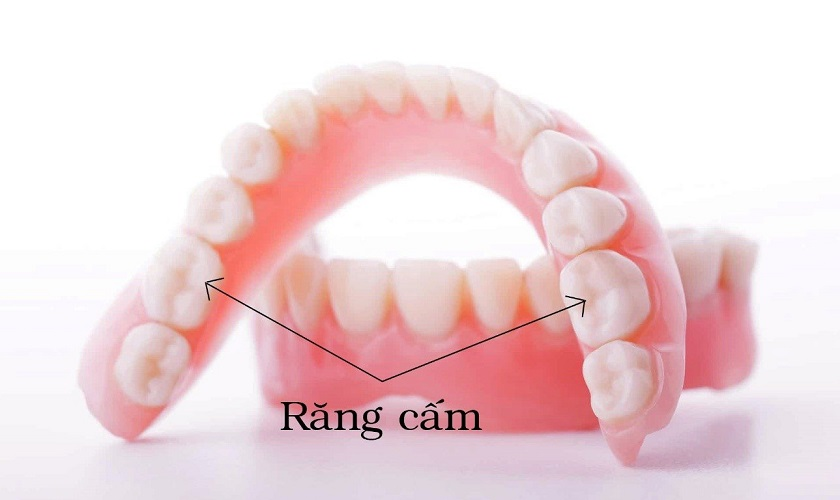 Răng cấm là răng nào?