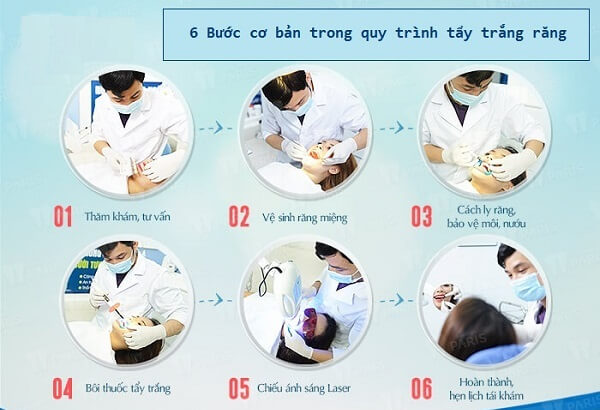 Các bước tẩy trắng răng