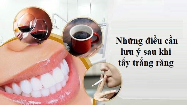 Tránh ăn thực phẩm và đồ uống có màu sau 2 tuần tẩy trắng răng